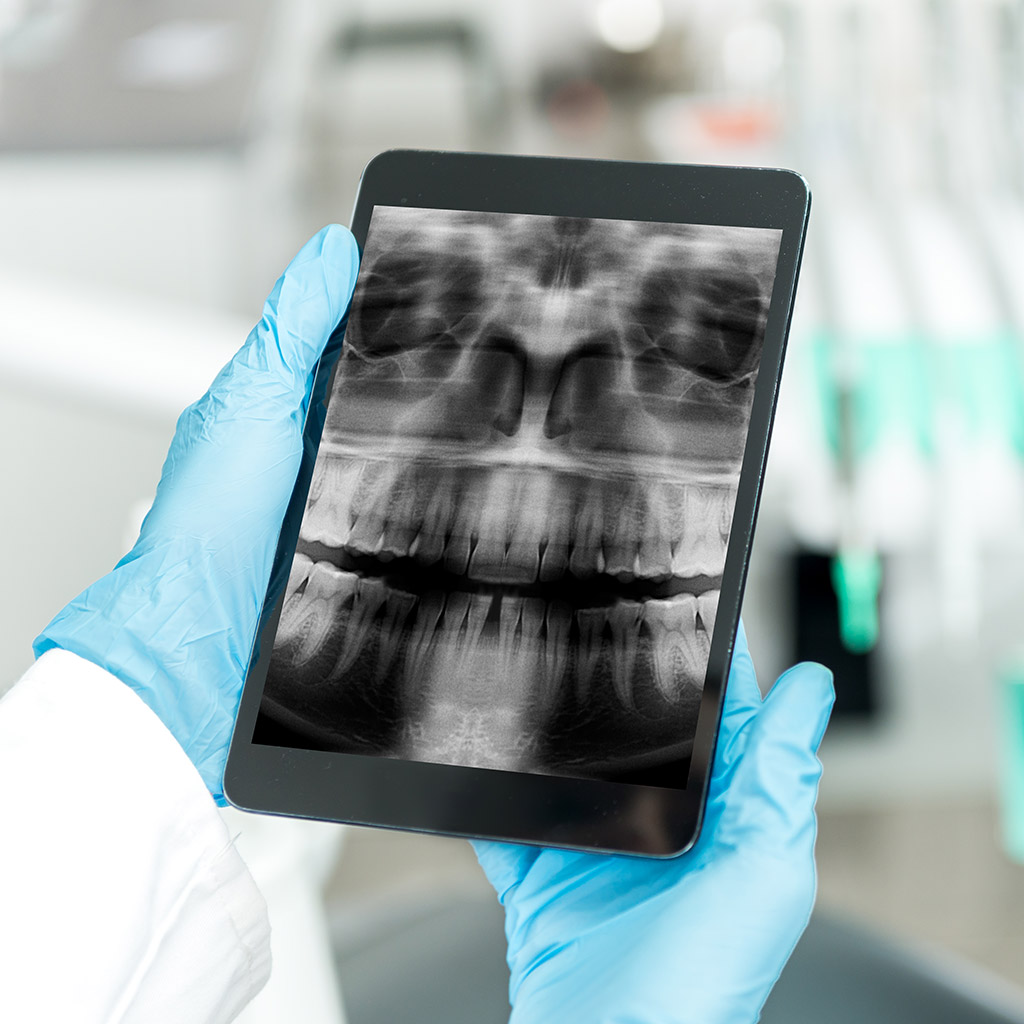 Surgical orthodontics