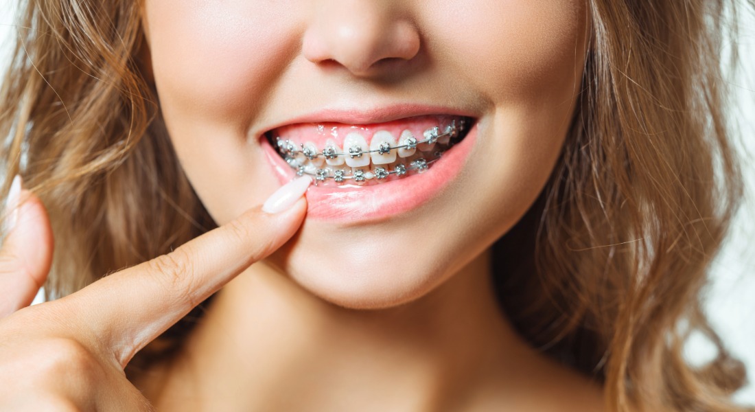 Orthodontic Emergencies