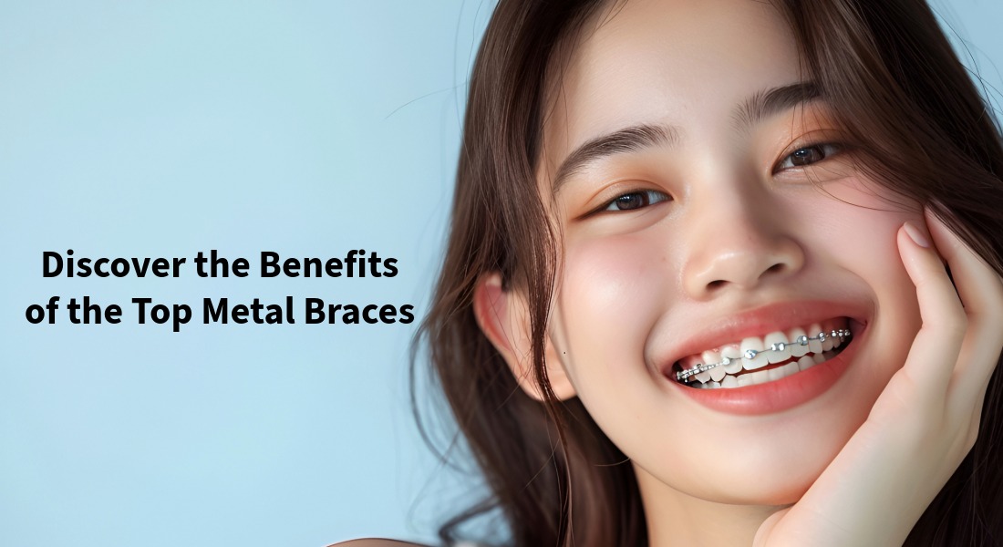 Top metal braces