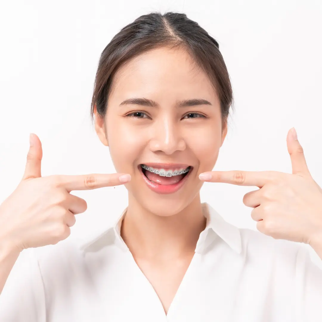 Braces vs lingual braces cost